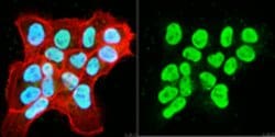 Wilms Tumor (WT33) Rabbit anti-Human, Polyclonal, MilliporeSigma 100 &mu;g;Unconjugated:Antibodies,